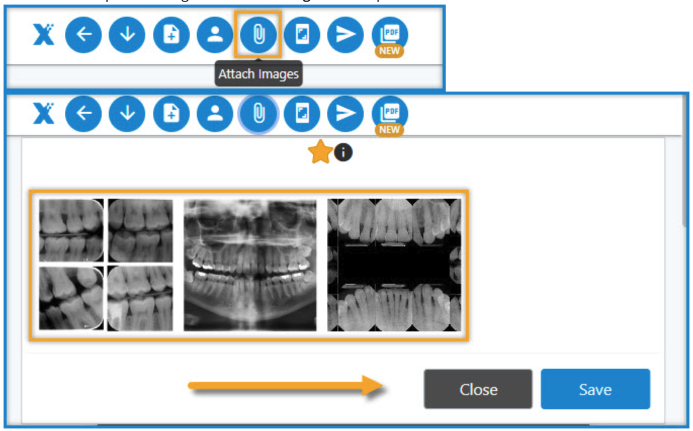screenshot of xrays on flex dental platform